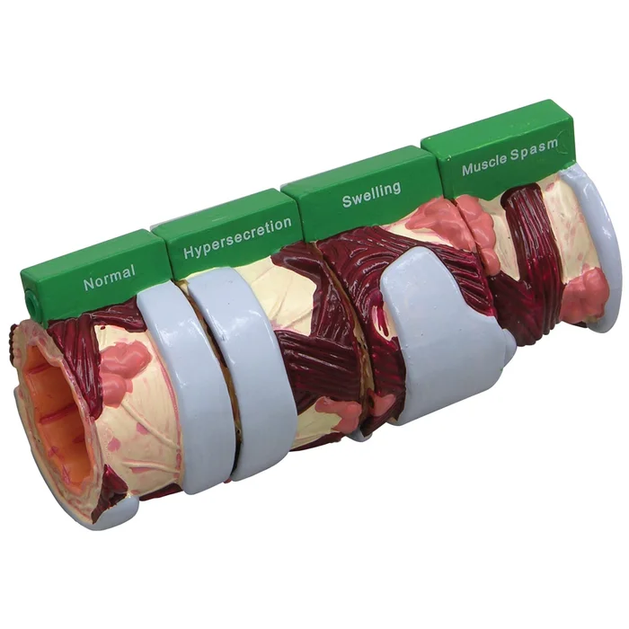 4-teiliges Bronchusmodell