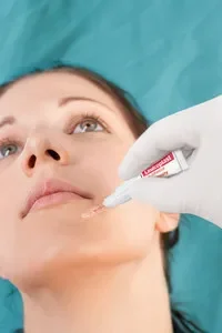 Leukoplast skin adhesive 0,36 ml