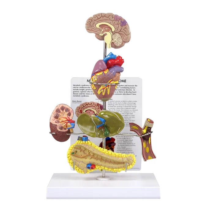 Modell eines metabolischen Syndroms