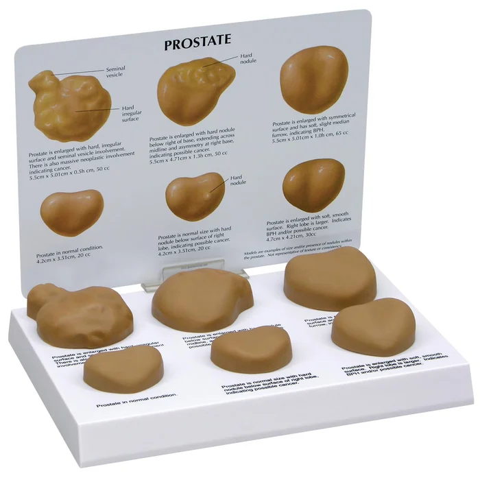 Prostatamodell